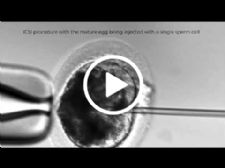 Advancing Equine Reproduction: How ICSI Is Transforming Sport Horse Breeding